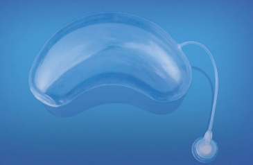 K500 Infected Balloon Tissue Expander Cylinder 500ml 69mm 2