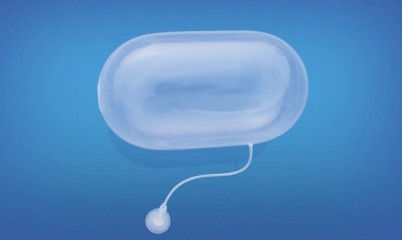 buy Silicone Cylinder Tissue Expander for Implantable Expander online manufacturer