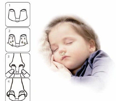 Good price 19mm Medical Nostril Support Device Wanhe Clear Nose Retainer After Rhinoplasty online