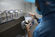 300cc Silicone Gel Breast Implants Crystal Lambe Prosthetic Memory Sterilization